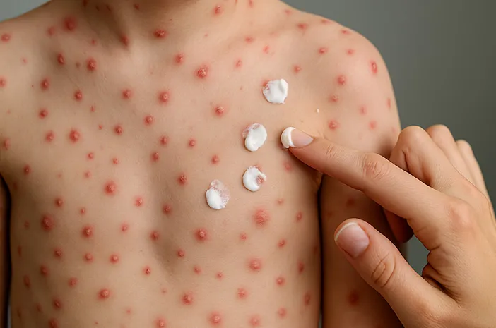 Pentingnya Herd Immunity